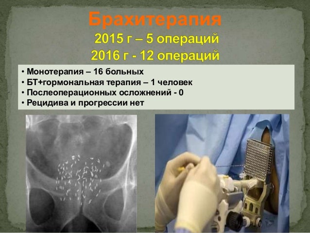 Анализ работы урологической клиники за 2016 г.