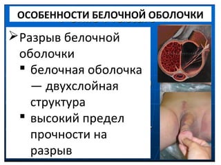 Лигирование вен полового члена – цены на хирургические операции в Санкт-Петербурге