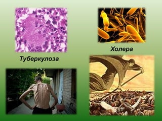 Туберкулоза
Холера
 