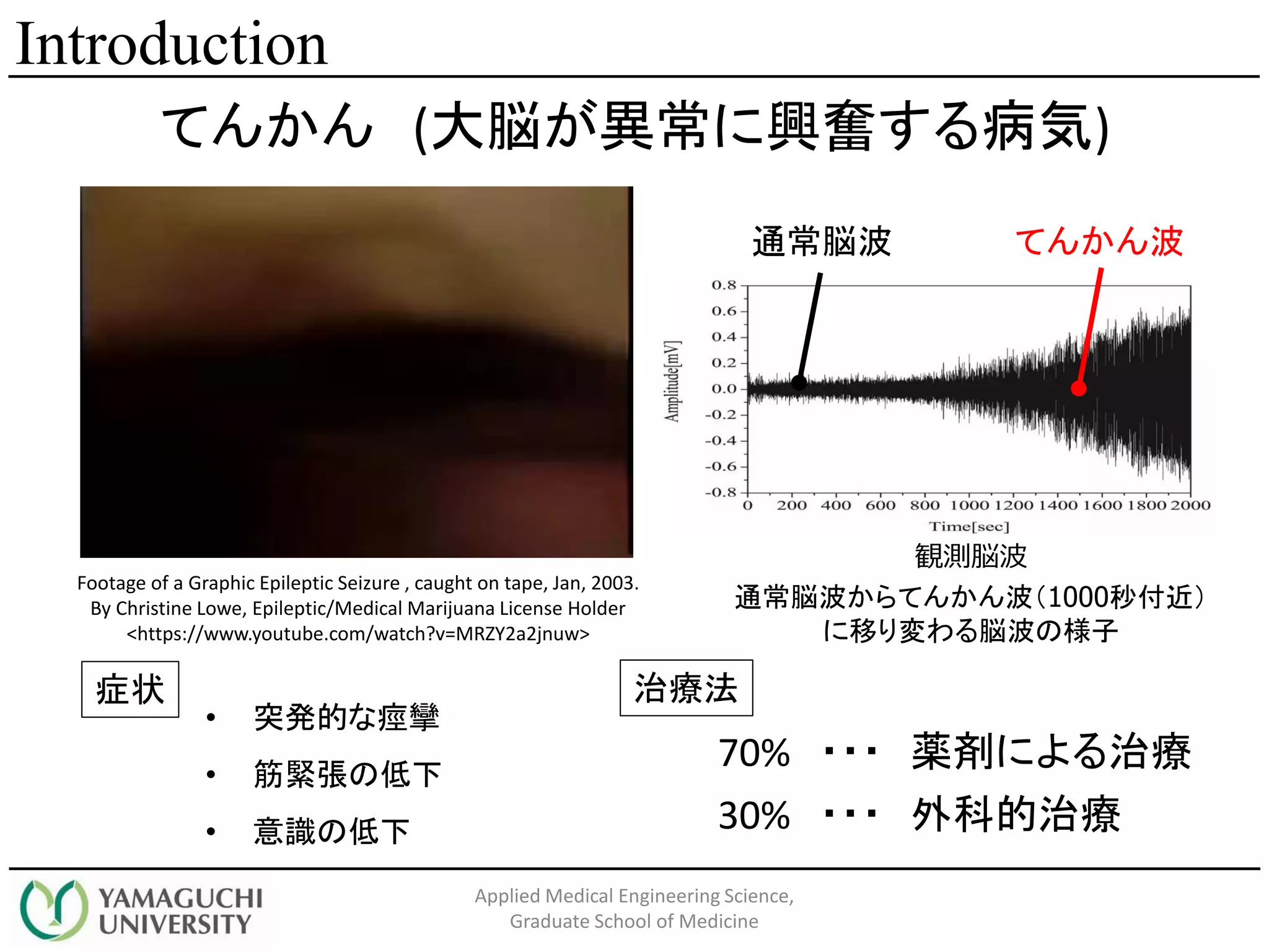 てんかん (大脳が異常に興奮する病気)
• 突発的な痙攣
• 筋緊張の低下
• 意識の低下
症状
Footage of a Graphic Epileptic Seizure , caught on tape, Jan, 2003.
By Christine Lowe, Epileptic/Medical Marijuana License Holder
<https://www.youtube.com/watch?v=MRZY2a2jnuw>
70% ・・・ 薬剤による治療
治療法
30% ・・・ 外科的治療
通常脳波 てんかん波
観測脳波
通常脳波からてんかん波（1000秒付近）
に移り変わる脳波の様子
Introduction
Applied Medical Engineering Science,
Graduate School of Medicine
 