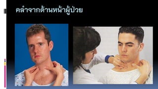 คลำจำกด้ำนหน้ำผู้ป่วย
 