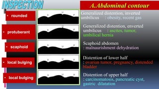 Generalized distention, inverted
umbilicus : obesity, recent gas
Generalized distention, enverted
umbilicus : ascites, tumor,
umbilical hernia
Scaphoid abdomen
: malnaurishment dehydration
Distention of lower half
: ovarian tumor, pregnancy, distended
bladder
Distention of upper half
: carcinomatosis, pancreatic cyst,
gastric dilatation
A.Abdominal contour
• rounded
• protuberant
• scaphoid
• local bulging
• local bulging
 