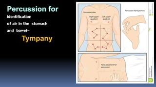 identification
of air in the stomach
and bowel-
Tympany
 