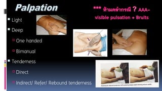  Light
 Deep
 One handed
 Bimanual
 Tenderness
 Direct
 Indirect/ Refer/ Rebound tenderness
 