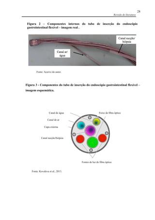 Revisão de literatura
28
Fonte: Acervo do autor.
Figura 2 – Componentes internos do tubo de inserção do endoscópio
gastrointestinal flexível – imagem real .
Fonte: Kovaleva et al., 2013.
Canal de água
Canal de ar
Canal sucção/biópsia
Fontes de luz de fibra óptica
Capa externa
Figura 3 - Componentes do tubo de inserção do endoscópio gastrointestinal flexível –
imagem esquemática.
Feixe de fibra óptica
 