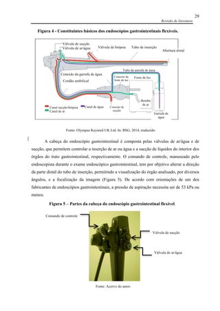 Revisão de literatura
29
A cabeça do endoscópio gastrointestinal é composta pelas válvulas de ar/água e de
sucção, que permitem controlar a inserção de ar ou água e a sucção de líquidos do interior dos
órgãos do trato gastrointestinal, respectivamente. O comando de controle, manuseado pelo
endoscopista durante o exame endoscópico gastrointestinal, tem por objetivo alterar a direção
da parte distal do tubo de inserção, permitindo a visualização do órgão analisado, por diversos
ângulos, e a focalização da imagem (Figura 5). De acordo com orientações de um dos
fabricantes de endoscópios gastrointestinais, a pressão de aspiração necessita ser de 53 kPa ou
menos.
Válvula de ar/água
Fonte: Acervo do autor.
Comando de controle
Válvula de sucção
Figura 5 – Partes da cabeça do endoscópio gastrointestinal flexível.
Fonte: Olympus Keymed UK Ltd. In: BSG, 2014, traduzido.
.
Válvula de sucção
Válvula de ar/água Válvula de biópsia Tubo de inserção
Abertura distal
Canal sucção/biópsia
Canal de ar
Canal de água
Conexão da garrafa de água
Conexão de
sucção
Garrafa de
água
Bomba
de ar
Fonte de luz
Tubo da garrafa de água
Cordão umbilical
Conector da
fonte de luz
Figura 4 - Constituintes básicos dos endoscópios gastrointestinais flexíveis.
 