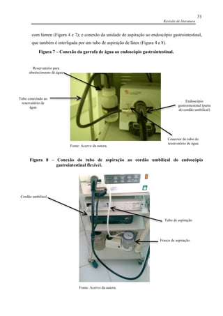 Revisão de literatura
31
com lúmen (Figura 4 e 7); e conexão da unidade de aspiração ao endoscópio gastrointestinal,
que também é interligada por um tubo de aspiração de látex (Figura 4 e 8).
Reservatório para
abastecimento de água
Tubo conectado ao
reservatório de
água
Endoscópio
gastrointestinal (parte
do cordão umbilical)
Fonte: Acervo da autora.
Conector do tubo do
reservatório de água
Figura 7 – Conexão da garrafa de água ao endoscópio gastrointestinal.
Fonte: Acervo da autora.
Cordão umbilical
Tubo de aspiração
Frasco de aspiração
Figura 8 – Conexão do tubo de aspiração ao cordão umbilical do endoscópio
gastrointestinal flexível.
 