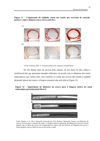 Revisão de literatura
37
Os três demais tipos de escovas (três cabeças, de uso único de uma cabeça e
reutilizável) têm que apresentar tamanhos diferentes, de acordo com os diâmetros dos canais
endoscópicos, que variam, pois, caso contrário, as cerdas das escovas não tocarão a sujidade
da parede interna dos canais e a limpeza mecânica não será efetiva (Figura 12).
(A)
(B)
Fonte: Charlton, 2007. A: Controle positivo; B: Limpeza com pull thru®
Figura 11 – Comparação da sujidade visual nos canais que serviram de controle
positivo e após a limpeza com a escova pull thru.
Fonte: Bajolet et al., 2013 (fotografia fornecida por LTA Medical, Montreuil, France). (a) Diâmetro da
escova é correto para o tamanho do canal, e a limpeza efetiva é garantida. (b) Diâmetro da escova é muito
grande, logo as fibras da escova são compactadas no canal e não são efetivas. (c) Diâmetro da escova é
muito pequena, logo as fibras da escova não tocam o canal.
Figura 12 – Importância do diâmetro da escova para a limpeza efetiva do canal
endoscópico gastrointestinal flexível
 