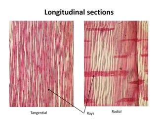 Wood anatomy and structure , wood and its products | PDF