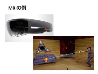 MR の例
 