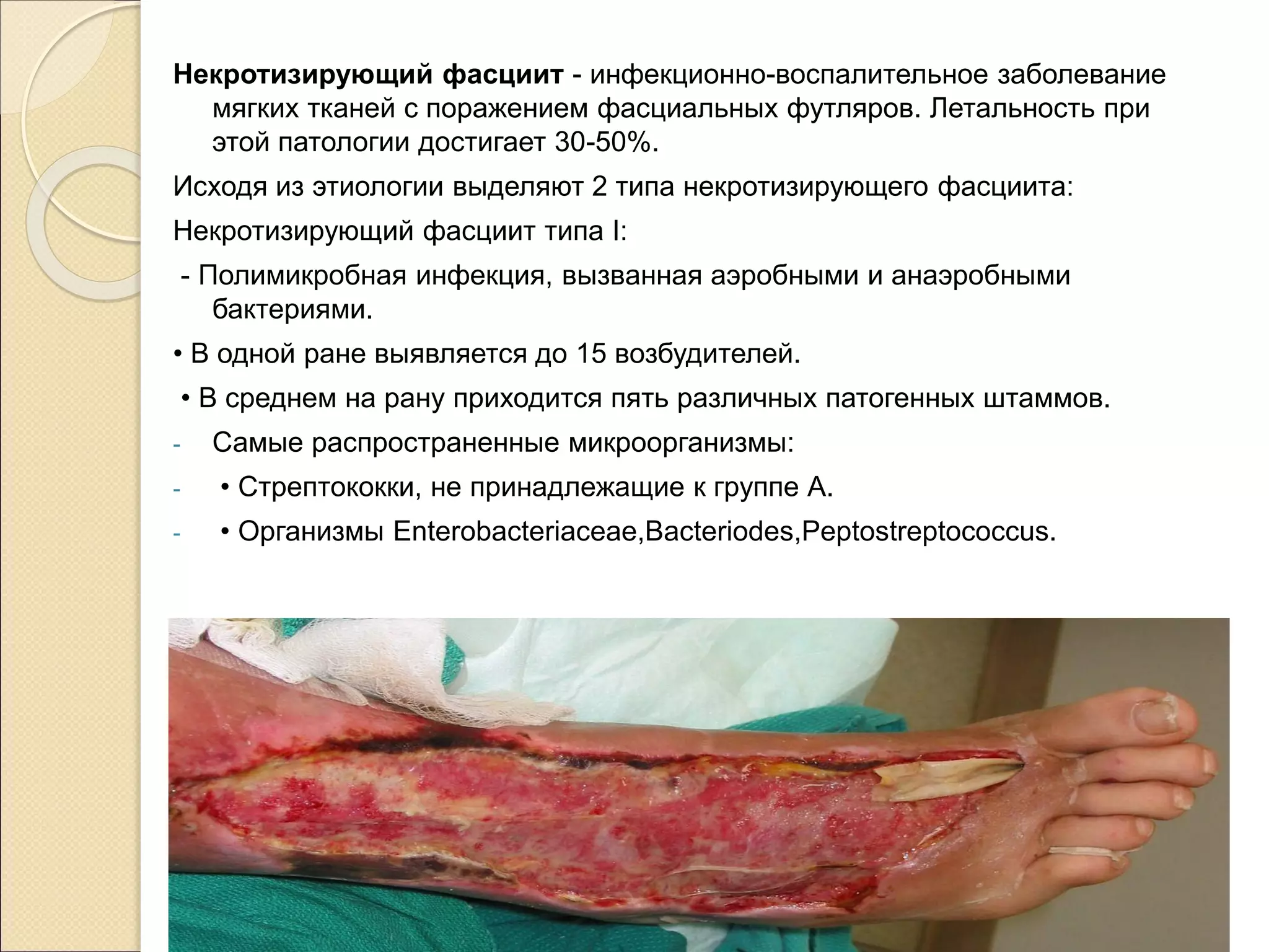 Некротизирующий фасциит - инфекционно-воспалительное заболевание
мягких тканей с поражением фасциальных футляров. Летальность при
этой патологии достигает 30-50%.
Исходя из этиологии выделяют 2 типа некротизирующего фасциита:
Некротизирующий фасциит типа I:
- Полимикробная инфекция, вызванная аэробными и анаэробными
бактериями.
• В одной ране выявляется до 15 возбудителей.
• В среднем на рану приходится пять различных патогенных штаммов.
- Самые распространенные микроорганизмы:
- • Стрептококки, не принадлежащие к группе А.
- • Организмы Enterobacteriaceae,Bacteriodes,Peptostreptococcus.
 