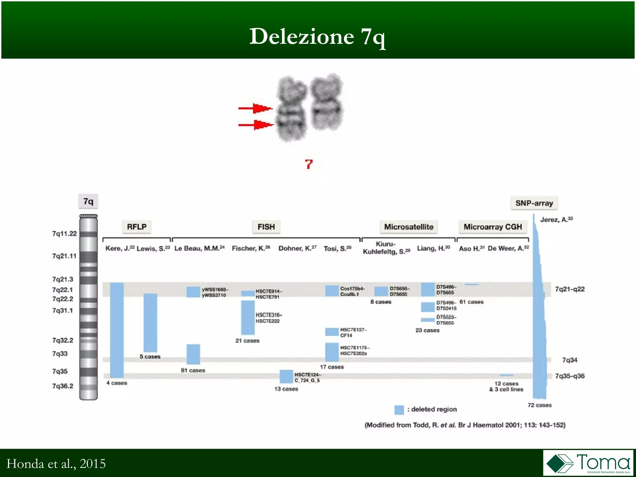 Delezione 7q
Honda et al., 2015
 