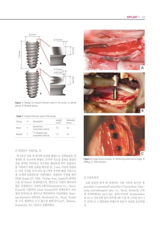 24 I Scientific Evidence 25IMPLANT I
quencies, and the resulting RF value, in hertz,
is converted automatically into implant stabil-
ity quotient (ISQ). Values range from 1 to 100,
and a high value indicates high implant stabil-
ity.
Measurement of removal torque
The bone block was placed in a locking vice
and fixed to transmit the removal torque longi-
tudinally. The torque was increased gradually
(displacement; 0.5 mm/min), and the point at
which the specimen became unfastened was re-
corded. The removal torque was measured with
the same torque gauge instrument (MG series;
MARK-IO Corporation) that was used to mea-
sure the insertion torque.
Insertion and removal torque data were ana-
lyzed by 2-way analysis of variance (ANOVA)
with location and preparation method, followed
by multiple comparisons using the Tukey Hon-
estly Significant Difference (HSD) multiple
comparison test. RFA data were analyzed by
2-way ANOVA to examine the effect of loca-
tion and preparation method and the 1-way
ANOVA, followed by the post hoc Tukey HSD
multiple comparison test to evaluate differenc-
es among the testing groups. The Pearson cor-
relation analysis was also performed to exam-
ine correlations between insertion torque, RFA
value, and removal torque. An alpha value of
.05 was used for statistical analysis. All calcula-
tions were performed with statistical software
(SAS version 9.1 for Windows; SAS Institute
Inc, Cary, NC). Data are presented as mean
(SD).
RESULTS
The mean insertion torques (SD) of each
group are presented in Table I. Among the
preparation methods, underpreparation had
significantly higher mean (SD) insertion torque
values (monocortical block, 104.57 (18.16): bi-
cortical block, 104.62 (18.58)) than the other
methods evaluated (P<.05). The osteotome
technique had the lowest mean (SD) values
(monocortical block, 58.92 (9.53); bicortical
block, 60.58 (15.49)). Two-way ANOVA revealed
that the preparation method had a signifi-
cant effect on the insertion torque (Table II)
(P<.001). However, there was no significant
effect for the location (P=.361). The interaction
between preparation method and location was
not significantly different (P=.277). The Tukey
HSD multiple comparison test showed signifi-
cant differences among standard preparation,
underpreparation, and osteotome techniques
(P<.05).
The mean RFA values (SD) of each group are
presented in Table III. Among the preparation
methods, the under-preparation method had
significantly higher mean (SD) RFA values in
the monocortical block (66.50 (2.59) and the
standard preparation method had significantly
higher RFA values in the bicortical block (68.40
Table I. Mean values (SD) of insertion torque (Ncm)
Standard
Preparation
Under
Preparation
Osteotome
Technique
Monocortical
fixation
89.45 (10.03)a
104.57 (18.16)b
58.92 (9.53)c
Bicortical
fixation
76.98 (15.84)a
104.62 (18.58)b
60.58 (15.49)c
Different lower case letters in same column indicate significant differences
(P<.05)
Table II. Two-way ANOVA for insertion torque
Source
Sum of
Squares
df
Mean
Squares
F P
Corrected
model
20917 5 4183 18.41 001
Location (A) 193 1 193 0.85 .3601
Preparation
method (B)
20125 2 10063 44.28 <.001
A × B 598 2 299 1.32 .277
Error 12271 54 227
(5.87)) than other methods evaluated (P<.05).
Similar to the insertion torque values, the os-
teotome technique had the lowest mean (SD)
RFA values (monocortical block 58.90 (3.63),
bicortical block 58.80 (4.08)) (Table III). Based
on the 2-way ANOVA, the preparation method
had a significant effect on the RFA values (Table
IV) (P<.001); however, there was no significant
effect on the location (P=.103). The Tukey HSD
multiple comparison test showed there were
significant differences among standard prepa-
ration, underpreparation, and the osteotome
technique (P<.05). There was significant inter-
action between the location and preparation
methods for the RFA values (P=.045). There-
fore, based on the preparation method and
location, modified 1-way ANOVA analysis and
the Tukey HSD multiple comparison test were
conducted. These revealed that there was a sig-
nificant difference in standard preparation ac-
cording to the location (P=.039), but there was
no significant difference in underpreparation
(P=1.00) and osteotome technique (P=1.00).
The mean removal torque values (SD) of
each group are presented in Table V. Two-way
ANOVA revealed that location and preparation
method had a significant effect on the removal
torque (Table VI) (P<.001). There was no sig-
nificant interaction between preparation meth-
od and location on removal torque (P=.641).
Among the preparation methods, there was no
significant difference between standard prepa-
ration and underpreparation (P=.897); how-
ever, there was a significant difference between
standard preparation and osteotome technique
and between underpreparation and osteotome
technique (P<.05). As for the difference of the
location, bicortical fixation method had signifi-
cantly higher removal torque values than the
monocortical fixation method (P<.05) (Table V).
Statistically significant correlations were
found between insertion torque and RFA values
(r=0.529, P<.001), insertion torque and removal
torque values (r=0.517, P<.001) and removal
torque and RFA values (r=0.481, P<.001).
Table III. Mean values (SD) of RFA values (ISQ)
Standard
Preparation
Under
Preparation
Osteotome
Technique
Monocortical
fixation
63.30 (2.5)a
66.50 (2.59)b
58.90 (3.63)d
Bicortical
fixation
68.40 (5.87)c
66.30 (2.54)b
58.8 (4.08)d
Different lower case letters in same column indicate significant differences
(P<.05)
Table V. Mean values (SD) of removal torque (Ncm)
Standard
Preparation
Under
Preparation
Osteotome
Technique
Monocortical
fixation
40.53 (12.17)aa
38.32 (7.60)aa
17.02 (7.48)ba
Bicortical
fixation
54.64 (12.04)ab
53.28 (11.86)ab
26.23 (9.88)bb
Different lower case letters in same column indicate significant differences
(P<.05)
Table IV. Two-way ANOVA for RFA values
Source
Sum of
Squares
df
Mean
Squares
F P
Corrected
model
839 5 168 12.02 <.001
Location (A) 38 1 38 25.39 .103
Preparation
method (B)
709 2 354 2.75 <.001
A × B 92 2 46 3.29 .045
Error 754 54 14
Table VI. Two-way ANOVA for removal torque
Source
Sum of
Squares
df
Mean
Squares
F P
Corrected
model
10949 5 2190 20.37 <.001
Location (A) 2442 1 2442 22.72 <.001
Preparation
method (B)
8410 2 4205 39.13 <.001
A × B 96 2 48 0.45 .641
Error 5804 54 107
 