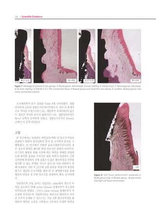 30 I Scientific Evidence 31IMPLANT I
임플란트의 초기안정성에 관한 고찰: 성견에서의 실험적 연구
Journal of Dental Implant Research 2013, 32(2) 33-39
김영각1
, 김성탁2
, 현 기1
, 황석현1
, 김재만1
, 주 총2
, 전상호1
, 최연조3
, 류재준3
, 권종진1
1
고려대학교 의과대학 안암병원 치과학교실 구강악안면외과, 2
고려대학교 의과대학 임상치의학대학원, 3
고려대학교 의과대학 안암병원 치과
학교실 보철과
Study of initial stability change of implant: an experimental study in the dog
Young-kak Kim1
, Sung-tak Kim2
, Ki Hyun1
, Suk-hyun Hwang1
, Jae-man Kim1
, Cong Zhou2
, Sang-ho
Jun1
, Yeon-jo Choi3
, Jae-jun Ryu3
, Jong-jin Kwon1
1
Division of Oral and Maxillofacial Surgery, Department of Dentistry, Anam Hospital, Korea University College of Medi-
cine,
2
Graduate School of Clinical Dentistry, Korea University,
3
Division of Prosthodontics, Department of Dentistry, Anam Hospital, Korea University College of Medicine, Seoul, Korea
PURPOSE :
The purpose of study was to analyze the initial stability change of N company A implant.
MATERIALS AND METHODS :
A total of 32 implant were placed in 4 mongrel dogs. Implant were divided into 2 groups following to
manufacturer. Group 1 is consisted of 16 of A implant (N co., Seoul, Korea), and Group 2 is consisted
of 16 of B implant (C co., Seoul, Korea). After implant placement, ITV (insertion torque value), ISQ
(implant stability quotient), PTV (periotest value) were measured immediately, 2 weeks, 4 weeks and
16 weeks of healing period. With the animal’s sacrifice 12 weeks after implant installation and histo-
morphometric analyses were performed. Statistical analyses were performed using SPSS for window
(ver.20.0 SPSS Inc.). Statistical differences were considered significant at p<0.05.
RESULTS :
There was significant difference of ITV, ISQ, PTV between A implant and B implant at all of period
(p<0.05). There was no significant difference of initial stability change of A implant (p<0.05). The
percentage of direct bone-to-implant contact (BIC) and bone area ratio (BA) showed statistical signifi-
cant between group 1 and 2 at 12 weeks (p<0.05).
CONCLUSION :
These result indicate that A implant does not have stability dip. In conclusion, A implant allows
immediate or early loading implant protocol. (JOURNAL OF DENTAL IMPLANT RESEARCH
2013;32(2):33-39)
Key words :
Implant, Initial stability, Stability dip, Immediate loading
서론
최근 임플란트가 대중적으로 많이 적용됨으로써 환자들
의 요구 및 시술자의 필요성에 의해 전통적인 치료시기를
줄이고자 하는 많은 노력이 요구되며, 그에 따라 임플란
트의 치유기간에 대해 연구가 많이 진행되어 왔다. 2002
년 스페인 World Congress에서는, 즉시 및 조기 하중부여
가 많은 임상케이스에서 성공적으로 적용될 수 있음을 보
고하였다1)
. 1990년 Schnitman 등에 의하면 즉시 로딩 임
플란트의 성공률은 85.7%로 보고되었으며2)
, 최근 Kan과
Rungcharassaeng에 의하면 단일 치아 임플란트에서는
100%까지도 보고되고 있다3)
. 2006년 Lioubavina-Hack,
Natalia 등에 의하면 즉시 및 조기 하중부여의 가장 중요
한 요소 중의 하나는 초기안정성이라고 연구한 바 있다4)
.
하지만, Simunek 등의 연구에 의하면 초기 안정도에서 즉
시 및 조기 하중부여에 제한을 가하게 만드는 요인 중 하나
는 ‘Stability dip’이다5)
. 임플란트는 식립 후 약 4주∼6주
사이에 일차적 안정도가 떨어지면서 그 떨어진 만큼을 아
직 올라가는 이차적 안정도가 충분히 상쇄하지 못하여 안
정도 저하 현상이 나타나게 된다6)
. 이 시기에 하중을 부여
하게 되면 골유착에 실패하게 된다7)
. 이러한 Stability dip
을 줄여 안정도의 일정한 유 지가 가능하게 할 수 있다면
즉시 및 조기 하중부여에 유리한 조건을 만들어 줄 수 있
다. 안정도의 저하를 극복하기 위한 노력으로는 일차적으
로 기계적 안정도를 높이기 위해 임플란트의 전반적인 모
양을 taper 형태로 제작하는 방법, 임플란트의 thread 디
자인을 변경하는 방법, 임플란트 식립 시 under-drilling
을 이용하는 방법, 임플란트의 상부 표면에 미세 나사산을
형성하는 방법 등을 통해 ITV (insertion torque value)를
물리적으로 높여 주어 초기 안정도에 기여하는 여러 가지
테크닉들이 소개되었다. 다음으로 생물학적 안정도를 높이
기 위한 방법들로는 주로 임플란트의 표면처리를 개선하는
형태로 소개되고 있다. HA 코팅 임플란트나 SLA 표면처
리 임플란트 등을 필두로 표면에 친수성을 부여한 임플란
트까지 출시되어 각광을 받고 있다8)
. 본 연구에서는 표면
처리된 임플란트의 연구와 즉시 및 조기 하중부여의 연구
사이에 상관관계를 찾기 위해, 최근 출시된 N사의 SLA 표
면처리된 임플란트인 A implant를 이용하여 stability dip
의 형성 유무와 즉시 및 조기하중 부여의 가능성에 대해 살
펴보았다9)
.
대상 및 방법
1. 실험동물
영구치가 완전히 맹출되고 체중이 20 kg 내외인 생후 1
년 전후의 수컷 성견 총 4마리를 동일한 조건 하에서 약 2
주간 사육한 후 실험하였다.
2. 실험재료
실험에 사용한 임플란트는 N사의 A 임플란트 16개와 C
사의 B 임플란트 16개를 사용하였다. 사용된 임플란트 모
두 직경 4.0 mm에 길이 10 mm 크기로 총 32개의 임플란
트가 사용되었다.
1) N사의 A implant
Root form - tapered submerged type의 fixture 디자
인을 갖고 있으며, SLA (Sandblasted, Large grit, Acid-
etched) 표면처리 되어 있고, 상부에 micro thread가 없
는 직경 4.0 mm, 길이 10mm의 임플란트 16개를 식립하
였다.(Fig. 1)
2) C사의 B implant
Flat soulder tapered submerged type의 fixture 디자
인을 갖고 있으며, RBM (Resorbable Blasted Media) 표
면처리 되어 있고, 최상부에 machined surface, 상부에는
double micro-thread, micro-thread의 2중 구조를 갖
고 있다. Fixture 직경은 4.0 mm, 길이는 10 mm의 임플
란트 16개를 식립하였다.(Fig. 2)
Figure 2. C company B implant. (A) Picture of implant, (B) Illus-
tration of structure of implant, (C) X-ray image of implant.
A B C
Figure 1. N company A implant. (A) Picture of implant, (B) Illus-
tration of structure of implant, (C) X-ray image of implant.
A B C
 