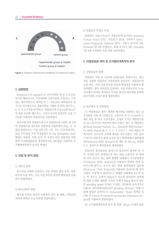 62 I Scientific Evidence 63IMPLANT I
Augmenting the surface roughness using
various methods may enhance the resistance
to shear force and maximize the initial fixation
and osteoconduction effect.5,6
Since histologic evaluations of implant os-
seointegration have been conducted primarily
in animals, less is known of the actual os-
seointegration reaction in humans.
The occasional case reports and histologic
evaluations of implants removed from humans
as a result of prosthesis failure and poor place-
ment are a great help. In this case report, the
authors evaluate an implant placed in the
maxillary anterior area that was removed to-
gether with the adjacent bone to examine the
osseointegration reaction by assessing the BIC
ratio, bone density, and histologic findings.
Case report
A 53-year-old woman was referred to the Bos-
ton Hub Dental Clinic, Seoul, Korea, because
she developed persistent discomfort near the
nasal cavity after implant treatment performed
at another dental clinic. The cause was found to
be perforation of the nasal floor by an implant
placed in the maxillary left canine area (Fig
1). The placement angle and depth were deter-
mined to be inappropriate for fabrication and
maintenance of a maxillary prosthesis. This
implant had been placed immediately after
tooth extraction and subjected to early loading
6 weeks after placement by connecting provi-
sional acrylic resin teeth enforced with wires to
adjacent implants.
Ten months after implant placement, no
movement of the implant or inflammation of
the periodontal tissues was detected. The im-
plant (SinusQuick EB, Neobiotech) was seen
to have perforated the nasal cavity using pan-
oramic radiographs and computed tomogra-
phy scans. The surgical record of the referring
dental clinic indicated that the implant was
11.5 mm in length and 4.0 mm in diameter. A
provisional tooth was prepared using an os-
seointegrated posterior implant. Underlocal
anesthesia, a full-thickness flap was elevated,
and the implant was removed together with
the adjacent bone using a trephine bur 4.5 mm
in diameter. No BIC had developed at the im-
plant apex (Figs 2 and 3). The removed sample
was fixed immediately in 10% formalin solution
and sent for histologic evaluation. At the time
of implant removal, an additional implant was
placed in an adjacent area.
Histologic findings
The implant specimen was fixed in 10% neu-
tral-buffered formalin, dehydrated in a graded
Fig 1 The implant placed in the maxillary left canine area had penetrated
the nasal fossa.
Fig 2 Appearance after removing the implant using
a trephine bur.
series of alcohols, and embedded in methyl
methacrylate. The samples were cut parallel
to the longitudinal axis of the implant in the
mesiodistal plane using an Exakt cutting and
grinding system (Exakt). The sections were
ground to a thickness of 20 μm and stained us-
ing hematoxylin-eosin.
The following parameters were measured
using image-analyzing software (Analysis LS
starter version 2.8, Olympus): BIC (the length
of the bone surface border in direct contact with
the implant divided by the complete implant
periphery) and interthread bone density (the
area of bone inside the threads divided by the
complete area inside the threads).
The implant showed osseointegration with the
adjacent bone tissue (Figs 4 and 5). The BIC
pattern appeared to produce broad-based direct
contact. Well-organized lamellar bone contain-
ing osteocytes was observed along the implant
surface (Fig 6). The mean BIC was 88.08%, and
the mean interthread bone density was 78.46%.
Fig 3 Histologic view of the implant (original magnification ×1.25). No BIC developed at
the implant apex (arrow).
Fig 4 Higher magnification of box A in Fig 3.
Fig 5 Higher magnification of box B in Fig 3.
Fig 6 Higher magnification of box in Fig 5.
 