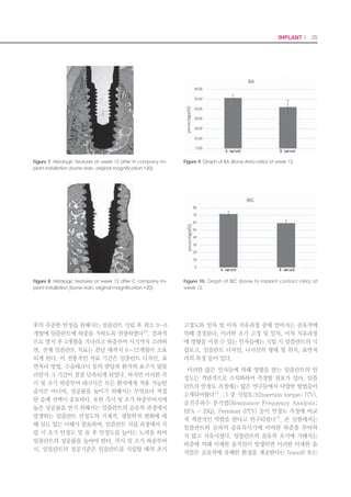68 I Scientific Evidence 69IMPLANT I
1. Introduction
Various factors must be considered for long-
term implant treatments to be functionally and
esthetically successful. The initial stability of
the implant, osseointegration, and soft tissue
healing are essential for successful treatment,
and the function and aesthetics of implants
must be maintained by protecting osseo-inte-
gration after loading with a firm biological seal
of the surrounding soft tissues.1
The causes of early marginal bone resorption
include periosteal elevation, bone reduction, ex-
cessive stress, bacterial invasion, and invasion
of the biological width after implant surgery.2
Peri-osteal elevation after surgery may affect
the blood supply; if there is rich cancellous
bone at the site, its impact on the absorption of
the cortical bone is insignificant.2
While there
are claims that trauma due to drilling during
implant insertion causes initial alveolar bone
loss,3
there are often cases in which the bone
increased.2
If an overload is transferred to the
bones that surround the implant, early margin-
al bone resorption occurs,4,5
however relatively
weak loading or progressive loading prevents
bone resorption.6,7
Bacteria are the fundamen-
tal cause behind the loss of surrounding bones
in the dentulous regions; but the role of bacte-
ria in bone loss associated with implants is lim-
ited and it is difficult to view bacteria the cause
of early marginal bone resorption.8-10
It has been shown that even in implants, mar-
ginal bone resorption occurs until the formation
of the least amount of soft tissue, called biologi-
cal width, which prevents osseointegration.11
There have been numerous studies of the im-
pact of the biological width on the surrounding
tissues in implants.12-15
Although the biological
width of implants is generally stable, over time
it typically increases in the junctional epithe-
lium attachment and decreases in the connec-
tive tissue attachment.14,15
Connective tissue
attachment is more important than junctional
epithelium attachment for preserving marginal
bone.16
The design of the cervical portion of implants,
located at the boundary between the soft and
hard tissues may affect soft tissue reaction and
marginal bone preservation.12,13,16
Platform
switching is a technique that connects an abut-
ment with a small diameter to the platform of
the inserted implant.17,18
It reduces marginal
bone resorption, not only by preventing the
apical down-growth of the barrier epithelium,
but also by reducing the stress applied to the
marginal bone.19-21
Moreover, the concave de-
sign of the transmucosal part of the implant is
shown to increase soft tissue thickness and en-
able firm attachment of the connective tissue.16
The surface roughness of the cervical portion
of implants or microthread design of implants
reduces marginal bone resorption.22,23
Thus, im-
plants with cervical designs have recently been
used extensively in clinical practice.22-24
Smooth implant surfaces may allow pro-
nounced downgrowth of epithelial tissue, unlike
rougher surfaces.25
Less epithelial downgrowth
and longer connective tissue seal is associated
with implants that have shallow horizontal
grooves than that associated with machined
implants.26
A grooved surface might have a
conductive effect on connective tissue adhesion
during healing, which would inhibit epithelial
downgrowth.27
Because microtextured implants
may enhance the tissue healing response
through their structural resemblance to the
natural extracellular matrix network,28,29
and
because pillars may reduce inflammation and
formation of capsules around implants,30
micro-
textures may inhibit epithelial downgrowth.26,27
Existing studies on the design of the cervical
portion of implants, which compared implants
from different manufacturers showed a certain
degree of difference in portions other than the
cervical portion and not only in the size but also
in the design; further, these studies could not
attribute the impact of using different implants
solely to the design of the cervical portion.12,16,22-
24
Furthermore, even among studies on the de-
sign of the cervical portion of the implant, very
few are on the design of the inferior transmu-
cosal portion of platform switching.
We evaluated the influence of design of the
transmucosal portion of inferior implants with
platform switches on changes in marginal bone
and soft tissue regenerations. For this in vivo
investigation, we produced and used implants
in the form of a straight bevel around the trans-
mucosal portion of the inferior platform switch;
implants with a concavity in the form of an “S”
for long attachment of connective tissues; or
implants with a microgroove in the form of an
“S”; further, the manufacturer, size, and overall
design were identical for all implants.
2. Materials and Methods
2.1 Implant Design
We used implants (Neobiotech Co., Seoul, Ko-
rea) with 3 designs of the transmucosal portion.
The bevel group had only a bevel in the trans-
mucosal part; the bioseal group had a smooth
S-shaped design; and the bioseal/groove group
had an S-shaped design with a micro-grooved
surface (Table 1). In addition to the transmu-
cosal portion, the implants consisted of a ta-
pered screw with an internal cone connection.
In all 3 groups, the transmucosal portion was a
machined surface, but the rest of the insertion
region consisted of surface-treated resorbable
blasting media (RBM) (RA = 1.2-1.5: Fig 1).
2.2 Animal Study Procedure
We used 6 healthy beagle dogs (without peri-
odontal disease) aged 1.5-2 years that weighed
12-15 kg. Animal selection, management,, and
surgical protocol were approved by the Eth-
ics Committee on Animal Experimentation of
Chonnam National University (CNU IACUC-
YB-R-2010-10). Tooth extraction from the test
animals was performed in a sterilized operat-
ing room, while the animals were under gen-
eral anesthesia. Anesthesia was induced using
muscular injection of 48 μg/kg of medetomidine
(Domitor®
, Pfizer, USA), 3 mg of tiletamine/ zo-
lazepam (Zoletil®
Virvac, France), and 5.4 mg/
kg of tramadol. Anesthesia was maintained
using 1-2% Isoflurane (Aerane®
, Ilsung Pharm.
Co., Seoul, Korea) and oxygen. To prevent
infection, 20 mg/kg of cefazolin (Cefazolin®
,
Chongkundang Pharm. Co., Seoul, Korea) was
intravenously injected into each animal, and
Table 1. Implant fixtures used in this study.
Group n Description of the
transmucosal part
Length
(mm)
Diameter
(mm)
Bevel 12 Bevel and
machined surface
7.5 3.5
Bioseal 12 S-shaped and
machined surface
7.5 3.5
Bioseal/
groove
12 S-shaped and
micro-groove
7.5 3.5
Figure 1. Design of the implant fixtures used in this study. (A)
Bevel group; (B) Bioseal group; and (C) Bioseal/groove group.
The implants in each group were identical in design, except
for the transmucosal portions. The transmucosal portion of the
bioseal/ groove group had the same size and shape as that
of the bioseal group, but had 0.015 mm micro-grooves placed
at 0.04 mm intervals along the surface.
 
