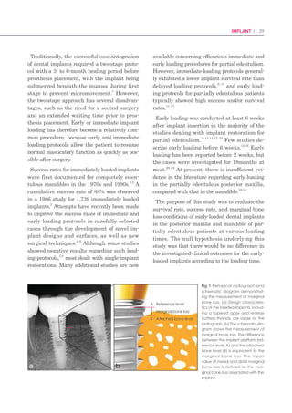 76 I Scientific Evidence 77IMPLANT I
5. Conclusion
Implants with an S-shaped concavity of the
transmucosal portion were associated with a
more favorable soft tissue response through the
formation of a firmer connective tissue barrier
than were implants with a straight bevel.
Acknowledgment
This research was supported by Basic Science Research
Program through the National Research Foundation
of Korea(NRF) funded by the Ministry of Education, Sci-
ence and Technology(2012005122) and the National
Research Foundation of Korea(NRF) grant funded by
the Korea government(MEST) (No. 2012-0001235).
References
LI Linkow, AW Rinaldi, WW Jr Weiss, et al., Factors1.	
influencing long-term implant success, J Prosthet
Dent, 63, 64 (1990).
CE Misch, Stress factors: influence on treatment2.	
planning: in Dental Implant Prosthetics, Misch CE
(ed), Elsevier Mosby, St. Louis, 71 (2005).
R Haider, G Watzek, H Plenk, Effects of drill cooling3.	
and bone structure on IMZ implant fixation, Int J
Oral Maxillofac Implants, 8, 83 (1993).
F Isidor, Loss of osseointegration caused by the4.	
occlusal load of oral implants. A clinical and ra-
diographic study in monkeys, Clin Oral Implants
Res, 7, 143 (1996).
J Duyck, HJ Rønold, HV Oosterwyck, et al., The5.	
influence of static and dynamic loading on mar-
ginal bone reactions around osseointegrated
implants: an animal experimental study, Clin Oral
Implants Res, 12, 207 (2001).
T Miyata, Y Kobayashi, H Araki, et al., The influ-6.	
ence of controlled occlusal overload on peri-im-
plant tissue. Part 3: a histologic study in monkeys,
Int J Oral Maxillofac Implants, 15, 425 (2000).
T Miyata, Y Kobayashi, H Araki, et al., The influ-7.	
ence of controlled occlusal overload on peri-im-
plant tissue. Part 4: a histologic study in monkeys,
Int J Oral Maxillofac Implants, 17, 384 (2002).
U Lekholm, I Ericsson, R Adell, et al., The condi-8.	
tion of the soft tissues at tooth and fixture abut-
ments supporting fixed bridges. a microbiological
and histological study, J Clin Periodontol, 13, 558
(1986).
R Adell, U Lekholm, B Rockler, et al., Marginal tis-9.	
sue reactions at osseointegrated titanium fixtures
(I). a 3-year longitudinal prospective study, Int J
Oral Maxillofac Surg, 15, 39 (1986).
TE Rams, TW Roberts, H Jr Tatum, et al., The sub-10.	
gingival microbial flora associated with human
dental implants, J Prosthet Dent, 51, 529 (1984).
T Berglundh, J Lindhe, Dimension of the periim-11.	
plant mucosa. biological width revisited, J Clin
Periodontol, 23, 971 (1996).
L den Hartog, HJ Meijer, B Stegenga, et al., Single12.	
implants with different neck designs in the aes-
thetic zone: a randomized clinical trial, Clin Oral
Implants Res, 22, 1289 (2011).
F Hermann, H Lerner, A Palti, Factors influenc-13.	
ing the preservation of the periimplant marginal
bone, Implant Dent, 16, 165 (2007).
DL Cochran, JS Hermann, RK Schenk, et al., Bio-14.	
logic width around titanium implants. a histo-
metric analysis of the implantogingival junction
around unloaded and loaded nonsubmerged
implants in the canine mandible, J Periodontol,
68, 186 (1997).
JS Hermann, D Buser, RK Schenk, et al., Biologic15.	
width around titanium implants. a physiologically
formed and stable dimension over time, Clin Oral
Implants Res, 11, 1 (2000).
S Kim, KC Oh, DH Han, et al., Influence of trans-16.	
mucosal designs of three one-piece implant sys-
tems on early tissue responses: a histometric study
in beagle dogs, Int J Oral Maxillofac Implants, 25,
309 (2010).
DM Gardner, Platform switching as a means of17.	
achieving implant esthetics, N Y State Dent J, 71,
34 (2005).
RJ Lazzara, SS Porter, Platform switching: a new18.	
concept in implant dentistry for controlling post-
restorative crestal bone levels, Int J Periodontics
Restorative Dent, 26, 9 (2006).
J Becker, D Ferrari, M Herten, et al., Influence of19.	
platform switching on crestal bone changes at
non-submerged titanium implants: a histomor-
phometrical study in dogs, J Clin Periodontol, 34,
1089 (2007).
Y Maeda, J Miura, I Taki, et al., Biomechanical20.	
analysis of platform switching: Is there any bio-
mechanical rationale?, Clin Oral Implants Res,
18, 581 (2007).
SE Quaresma, PR Cury, WR Sendyk, et al., A finite21.	
element analysis of two different dental implants:
stress distribution in the prosthesis, abutment, im-
plant, and supporting bone, J Oral Implantol, 34,
1 (2008).
HJ Yun, JC Park, JH Yun, et al., A short-term clini-22.	
cal study of marginal bone level change around
microthreaded and platformswitched implants, J
Periodontal Implant Sci, 41, 211 (2011).
SY Lee, CM Piao, JY Koak, et al., A 3-year pro-23.	
spective radiographic evaluation of the marginal
bone level around different implant systems, J
Oral Rehabil, 37, 538 (2010).
FD de Almeida, AC Carvalho, M Fontes, et al., Ra-24.	
diographic evaluation of the marginal bone lev-
el around internal-hex implants with a switched
platform: a clinical case report series, Int J Oral
Maxillofac Implants, 26, 587 (2011).
R Glauser, P Schüpbach, J Gottlow, et al., Peri-im-25.	
plant soft tissue barrier in experimental one-piece
mini-implants with different surface topographies
in humans: a lightmicroscopic overview and his-
tometric analysis, Clin Implant Dent Relat Res, 7,
44 (2005).
B Chehroudi, TR Gould, DM Brunette, Effects of a26.	
grooved titanium-coated implant surface on epi-
thelial cell behavior in vitro and in vivo, J Biomed
Mater Res, 23, 1067 (1989).
DM Brunette, The effects of implant surface to-27.	
pography on the behavior of cells, Int J Oral Max-
illofac Implants, 3, 231 (1988).
J Meyle, H Wolburg, AF von Recum, Surface mi-28.	
cromorphology and cellular interactions, J Biom-
ater Appl, 7, 362 (1993).
P Clark, P Connolly, AS Curtis, et al., Topographi-29.	
cal control of cell behavior: II. multiple grooved
substrata, Development, 108, 635 (1990).
GJ Picha, RF Drake, Pillared-surface microstruc-30.	
ture and softtissue implants: effect of the implant
site and fixation, J Biomed Mater Res, 30, 305
(1996).
LF Cooper, S Ellner, J Moriarty, et al., Three-year31.	
evaluation of single-tooth implants restored 3
weeks after 1-stage surgery, Int J Oral Maxillofac
Implants, 22, 791 (2007).
T Albrektsson, G Zarb, P Worthington, et al., The32.	
long-term efficacy of currently used dental im-
plants: a review and proposed criteria for suc-
cess, Int J Oral Maxillofac Implants, 1, 11 (1986).
K Nishimura, T Itoh, K Takaki, et al., Periodontal33.	
parameters of osseointegrated dental implants.
a 4-year controlled follow-up study, Clin Oral Im-
plants Res, 8, 272 (1997).
T Berglundh, J Lindhe, I Ericsson, et al., The soft34.	
tissue barrier in implants and teeth, Clin Oral Im-
plants Res, 2, 81 (1991).
R Glauser, P Schüpbach, J Gottlow, et al., Peri-im-35.	
plant soft tissue barrier in experimental one-piece
mini-implants with different surface topographies
in humans: a light-microscopic overview and his-
tometric analysis, Clin Implant Dent Relat Res, 7,
44 (2005).
H Ikeda, T Yamaza, M Yoshinari, et al., Ultrastruc-36.	
tural and immunoelectron microscopic studies
of the peri-implant epithelium-implant (Ti-6Al-4V)
interface of rat maxilla, J Periodontol, 71, 961
(2000).
I Abrahamsson, T Berglundh, J Wennström, et al.,37.	
The periimplant hard and soft tissues in different
implant systems. a comparative study in the dog,
Clin Oral Implants Res, 7, 212 (1996).
H Tenenbaum, JF Schaaf, FJ Cuisinier, Histological38.	
 