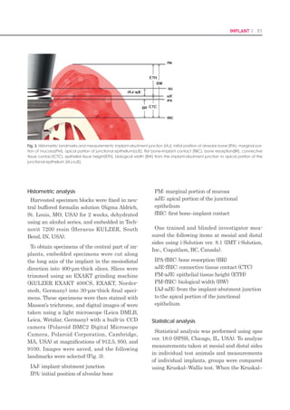100 I Scientific Evidence 101SINUS I
Fig. 18. Despite the use of D3-D4 bone, using
CMI fixation of the SiunsQuick implant, the
ideal initial fixation was achieved at a torque
of 40 Ncm.
Fig. 19. After the ideal initial fixation, a healing
abutment was mounted.
Fig. 17. A SiunsQuick 5.0 X 11.5-mm implant
was placed without the addition of bone.
Fig. 16. For implant placement, final drilling was
performed after S-reamer drilling. For CMI fixa-
tion, the placement protocol for a SinusQuick
5.0 X 11.5-mm implant was modified.
Fig. 15. The perforation was achieved to a
depth of 11 mm, which was greater than pre-
dicted by 3.0 mm. Drilling should be performed
in the direction of lateral wall. The nose was
obstructed, and a nose blow was performed
to confirm that the membrane of the maxillary
sinus was not perforated.
Fig. 21. Final delivery of the prosthesis after 2
weeks. As described here, even for cases in
which panoramic measurement was per-
formed incorrectly, use of the SCA kit safely
allowed perforation of the inferior cortical wall
without damage to the maxillary sinus mem-
brane. Thus, CMI fixation could be achieved.
Fig. 20. The initial fixation was achieved follow-
ing CMI fixation.
Fig. 14. No perforation occurred using an 8.0-
mm drill stopper. As a result, a 9.0-mm drill
stopper was used. However, no perforation
occurred even after using a 10.0-mm stopper.
An appropriate amount of bone should be8.	
placed in the hole using a bone carrier. The
bone should be inserted into sinus using a
bone condenser along with a drill stopper.
The appropriate amount of bone to be in-9.	
serted is determined based on the height
of elevation. In general, at an elevation of
1 mm, a volume of approximately 0.1 cc of
bone should be inserted.
According to the amount of bone inserted,10.	
spreading should be performed using a bone
spreader for lateral elevation of the mem-
brane. A bone spreader specifically designed
for contra-angle bends should be rotated at
a speed of 20-30 rpm for 10-20 s after using
a drill stopper 1-2 mm longer than the re-
sidual bone. Generally, spreading should be
performed after inserting at a volume of 0.3
cc.
Spreading should be performed whenever11.	
insertion involves a volume of 0.2-0.3 cc. For
cases with additional insertion, the length
of the stopper should be increased by 1 mm,
and this maneuver should be repeated.
When the bone grafting is finished, a drill12.	
can be used to enlarge the hole.
Based on the density of cortical bone, coun-13.	
tersinking should be performed (excluding
IT type). In general, this should be done for
D1-D2 bone quality. It doesn’t matter skip
the countersinking in D3 and D4 bone qual-
ity.
The implant should be placed when all drill-14.	
ing procedures have been completed.
Discussion
Various noninvasive surgical treatments have
been introduced as alternatives to maxillary
sinus bone elevation via an invasive lateral ap-
proach in clinic. The crestal approach is a rep-
resentative alternative to the lateral approach.
Elevation of the maxillary sinus membrane
via the crestal approach is a predictable sur-
gical procedure with almost no postsurgi-
cal complications. To secure a long-term and
stable prognosis, the selection of appropriate
indications and extensive training in surgical
technique are required. For cases in which the
amount of residual alveolar bone is insufficient,
excessive surgical attempts would lead to an
increased likelihood of surgical failure1)
.
The crestal approach is possible for cases in
which the height of residual alveolar bone to
the floor of the maxillary sinus exceeds 6 mm.
When the mucosa of the maxillary sinus is el-
evated via the crestal approach, it is dangerous
to attempt elevation 5 mm. Some authors fa-
vor a crestal approach, even for cases in which
the height of residual bone is greater than 6
mm. When multiple implants are placed in the
maxillary molar area, the lateral approach is
safer and reduces the duration of surgery com-
pared to the crestal approach2)
.
Zitzmann and Schärer3)
recommended the os-
teotome technique when residual bone height
exceeds 6 mm and an elevation of about 3 to 4
mm is expected. One-step or two-step lateral
antrostomy must be performed in cases of more
advanced resorption.
One of the methods associated with the cr-
estal approach, the sinus crestal approach
technique (SCA technique), can be drilled by
rotation of the S-reamer at a speed of 800-1200
rpm to achieve the required size. This surgical
procedure can be used for safe elevation with-
out causing damage to the membrane of the
 