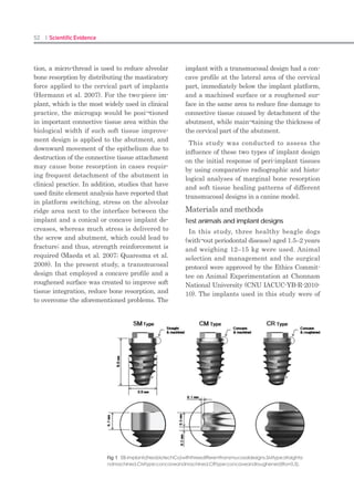102 I Scientific Evidence 103SINUS I
maxillary sinus. The kit includes four types of
S-reamer (2.4, 2.8, 3.2 and 4.6 mm diameters),
one depth gauge, 12 drill stoppers (1-12 mm),
two bone condensers, one bone carrier, and tow
bone spreaders with diameters of 2 mm and 3
mm.
CMI fixation (Crestal cortical fixation, Middle
cancellous fixation, and Inferior cortical fixa-
tion) is a new implantation method to increase
the success rate in areas where the bone is
weak and available space is insufficient, such
as the maxillary molar area.
CMI fixation achieves effective fixation in all
three areas, using specific implants for which
under-drilling and self-compaction techniques
can be performed. As a result, even in cases
in which the bone quality is poor, immediate
loading as well as a one-stage approach can be
attempted. When the crestal approach is at-
tempted, CMI fixation can minimize patient
discomfort while reducing the possibility of per-
foration of the maxillary sinus membrane.
However, because this method is a blind tech-
nique, it is associated with a risk of perforation
of the maxillary sinus membrane. When the
perforation is occurred, shorter implants place-
ment or a lateral approach is recommended.
References
Yu KH, et al: Socket lifting with osteotome tech-1.	
nique for implant installation in posterior maxilla:
review of the literature. Implantology 13: 214,
2009
Kim YK, et al: A new crestal approach for sinus2.	
floor elevation: Case reports. The Journal of the
Korean Academy of Implant Dentistry, 28: 41,
2009.
Zitzmann NU, Schärer P: Sinus elevation proce-3.	
dures in the resorbed posterior maxilla. Compari-
son of crestal and lateral approaches. Oral Surg
Oral Med Pathol Oral Radiol Endod, 85: 8, 1998.
Reprint requests to: Su-Gwan Kim
Department of Oral and Maxillofacial Surgery, School of Dentistry, Chosun University,
375, SeoSukDong, DongGu, GwangJu City, Korea. Zip Code: 501-759
Sinus Lateral Window Technique Using the SLA Kit
SU-Gwan KIM1)
, Ji-Su Oh1)
, Young-Ku HEO2)
1) Department of Oral  Maxillofacial Surgery, School of Dentistry, Chosun University, GwangJu, Republic of Korea
(Chief: Prof. Su-Gwan KIM)
2) Boston Hub Dental Clinic, Private Office, Seoul, Republic of Korea (Chief: Prof. Young-Ku HEO)
SUMMARY
The sinus lateral approach (SLA) kit is a new instrument that creates a 4-6mm hole in the lateral
antral wall. It is faster than other instruments developed to date. The sinus lateral window tech-
nique is safe because it reduces the risk of accidental perforation of the maxillary sinus membrane.
The process of lateral wall formation is simple and does not require specialized skills. Here, we report
our procedure.
KEY WORDS
Sinus lateral window technique, SLA kit
SLA kit components
1. LS-reamer (Fig.1, Table 1)
The lateral sinus (LS)-reamer is a drill used
for forming bony window via the lateral ap-
proach without preserving the bone core. There
are a total of six types of reamer with head di-
ameters of 4.5 , 5.5 and 6.5 mm and lengths of
2mm and 3.5mm.
Fig. 1. LS-reamer
Fig. 2. C-guide  C-reamer
Introduction
The bone support for implants in the posterior
part of the maxilla is often poor. This condition
may be treated by augmentation of the maxil-
lary sinus floor. The most common sinus floor
augmentation technique used involves elevat-
ing the sinus floor and increasing the bone vol-
ume by inserting a bone graft through a win-
dow in the lateral antral wall1-4)
The sinus lateral approach (SLA) kit is a new
instrument for easily and safely creating a
lateral window to perform the sinus lateral
window technique. The SLA kit is used for
cases in which application of a sinus crestal
approach(SCA)kit is difficult, including those in
which the residual bone is shorter than 3-4mm,
those in which the membrane is perforated
during the crestal approach, or those in which
multiple implants are placed simultaneously.
Hosp. Dent. (Tokyo) Vol. 22, No.1, 2010
 