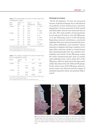108 I Scientific Evidence 109SINUS I
a safe procedure. This process of making a hole
in the lateral wall is simplified and can be per-
formed without specialized skills. The SLA
technique resolves the burdensome features
of the conventional types of the sinus lateral
approach(Table 3).
References
Kim YK, et al :A new crestal approach for sinus1.	
floor elevation: Case reports. The Journal of the
Korean Academy of Implant Dentistry, 28:41,
2009.
Toffler M: Treating the atrophic posterior maxilla2.	
by combining short implants with minimally inva-
sive osteotome procedures. Pract Proced Aes-
thet Dent, 18:301, 2006.
Fermergard R, Astrand P: Osteotome sinus floor el-3.	
evation and simultaneous placement of implants-
-a 1-year retrospective study with Astra Tech im-
plants. Clin Implant Dent Relat Res, 10:62,2008.
Kolerman R, Barnea E: [Crestal core elevation4.	
technique- -case series and literature review ] Re-
fuat Hapeh Vehashinayim, 25: 27, 2008.
Reprint requests to: Su-Gwan Kim
Department of Oral and Maxillofacial Surgery, School of Dentistry, Chosun University,
375, SeoSukDong, DongGu, GwangJu City, Korea. Zip Code: 501-759
Table 3. Advantages of the SLA technique
No Requirement for extensive flap opening: The procedure can•	
be performed with a minimal flap opening using the SLA-KIT.
No need for a large window: A stable approach can be com-•	
pleted without requiring a large window.
Does not require such instruments as a straight handpiece or•	
round bur: Preparation is simplified because the surgeon need
not use a straight handpiece or round bur. Damage to the mem-
brane during window formation can be minimized.
Minimal risk of arterial bleeding during window formation: The•	
procedure can be performed while monitoring blood vessels in
the area. Therefore, this is a safe procedure.
Risk of membrane tearing during a window formation: The spe-•	
cial shape of the reamer edge minimizes the risk of damage to
the membrane.
Risk of swelling and pain with extensive surgery: The degree of•	
swelling and pain can be markedly reduced by minimizing surgi-
cal time and scope.
Lack of confidence with regard to techniques of membrane el-•	
evation: Three types of custom-designed elevators can elevate
the membrane both safely and effectively.
Immediate loading with a new concept of maxillary sinus elevation
: S-reamer Osteotome Technique.
Richard Leesungbok(1) FP
, Suk-Won Lee (1), Su-Jin Ahn(1), Young-Ku Heo(2), HoonChang (3)
(1)Dept of Biomaterials  Prosthodontics,Schoolof Dentistry, Kyung HeeUniversity,
(2)Global Academy of Osseointegration,
(3) Harmony Dental Clinic
Seoul, Republic of Korea
Background  Aim
Once in a while, the malleting osteotome technique arises several post-operative complications such
as discomfort and inner auditory organ damage. Also the possibility of damage on the sinus mem-
brane with excessive fracture of sinus floor still remains.
This report introduced a new maxillary sinus floor elevation technique in which only the inferior cor-
tical wall underneath the sinus would be perforated without tearing of maxillary sinus membrane by
drilling instead of malleting using a rotary instrument, called S-reamer®
(Neobiotec Co., Seoul, Ko-
rea).
The objective of this presentation is to show our scientific and clinical experience related to implant
supported fixed restorations for the partially and fully edentulous jaws including a situation after si-
nus graft with S-reamer osteotome technique, and to assess the survival outcome of immediate load-
ing protocols according to their treatment sequence and selected prosthodontic design.
 