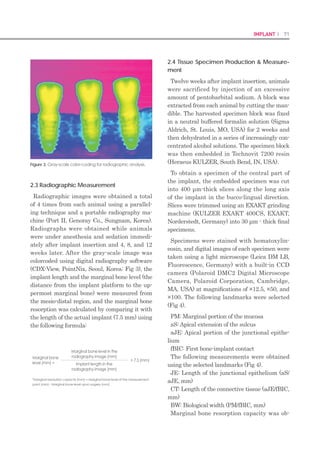 140 I Scientific Evidence 141SINUS I
piezoelectric use on open sinus lift perforation:
A retrospective evaluation of 56 consecutively
treated cases from private practices. J Periodon-
tol 2010; 81:167–171.
Nkenke E, Schlebel A, Schultze-Mosgau S, Neu-31.	
kam FW, Wiltfang J. The endoscopically controlled
osteotome sinus floor elevation: A preliminary
prospective study. Int J Oral Maxillofac Implants
2002; 17:557–566.
Kim YK, Kim SG. Sinus bone grafting technique us-32.	
ing special reamers and microelevators. Implant
Dent 2012;21:387–389.
Barone A, Santini S, Marconcini S, Giacomelli L,33.	
Gherlone E, Covani U. Osteotomy and membrane
elevation during the maxillary sinus augmenta-
tion procedure. A comparative study: Piezoelec-
tric device vs. conventional rotative instrumenta-
tions. Clin Oral Implants Res 2008;19:511–515.
Solar P, Geyerhofer U, Traxler H, Windisch A, Ulm34.	
C, Watzek G. Blood supply to the maxillary sinus
relevant to sinus floor elevation procedures. Clin
Oral Implants Res 1999;10:34–44.
Traxler H, Windisch A, Geyerhofer U, Surd R, Solar35.	
P, Firbas W. Arterial blood supply of the maxillary
sinus. Clin Anat 1999;12:417–421.
Kotrikova B, Wirtz R, Krempien R, et al. Piezosurgery:36.	
A new safe technique in cranial osteoplasty? Int J
Oral Maxillofac Surg 2006; 35:461–465.
Eggers G, Klein J, Blank J, Hassfeld S. Piezosurgery:37.	
An ultrasound device for cutting bone and its use
and limitations in maxillofacial surgery. Br J Oral
Maxillofac Surg 2004;42:451–453.
Fu PY. Piezoelectric-assisted osteotome-mediat-38.	
ed sinus floor elevation: An innovative approach.
Implant Dent 2010;19:299–306.
Vercellotti T, Kim DM, Wada K, Fiorellini JP. Os-39.	
seous response following resective therapy with
piezosurgery. Int J Periodontics Restorative Dent
2005;25:543–549.
Correspondence to: Dr Hakki Oguz Kazancioglu, Bezmialem, Vakif University, Faculty of
Dentistry, Department of Oral and Maxillofacial Surgery, 34093 Fatih, Istanbul, Turkey.
Fax: +90-212-5332326. Email: dt_oguz@yahoo.com
GBR
 