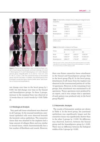 144 I Scientific Evidence 145GBR I
al, 2010). It was shown that such effects were
mainly originated from the green tea extract’s
antioxidant effect and the removal effect on
the active oxygen (Shen et al, 2011). EGCG,
one of the compounds in green tea extract, is
known to prevent bone resorption by inducing
the apoptotic cell depth of osteoclast and inhibi-
tion of osteoclast formation. Green tea’s extract
blocks the activity of NF-кB and inhibits the
generation of IL-1β. Consequently, it blocks the
formation of the osteoclast and inhibits bone
resorption (Nakamura et al, 2010). Recently, it
was also reported that EGCG enhances bone
formation by suppressing T3-stimulated syn-
thesis of osteocalcin, which is a determinant of
bone formation (Kato et al, 2011). If such effects
of green tea extract are applied to the defect
site of implant by being coated to BCP together
with ErhBMP-2, more beneficial effects will
surely be obtained.
The purpose of this study was to examine the
osteogenic potential of BCP coated with low-
concentrate ErhBMP-2 and epigallocatechin-
3-gallate (EGCG) and to evaluate the healing
aspect and the newly designed titanium barrier
membrane with a histological manner in dehis-
cence defects in dogs.
Materials and methods
Animals and experimental groups
In this study, five mongrel dogs (weighing ap-
proximately 30 kg) were used. For prestudy
preparation, scaling and plaque control were
performed for periodontal health. After treat-
ments, they were fed with liquid foods to pre-
vent masticatory trauma during healing. All
experiments were approved by the Animal
Care and Use Committee, Yonsei Medical Cen-
ter, Seoul, Korea (no. 2010-0362).
All of the surgical treatments were carried
out under anesthesia. Atropine (0.04 mg kg-1
:
Korea). This membrane was newly designed
for the customized titanium membrane. It can
provide various sizes of membrane, which are
suitable for treatment use and can bend the
membrane for attaching on that location. After
completing GBR, it can easily be removed with-
out additional flap surgery (Figure 1).
Each group was treated with bone graft ma-
terials and membranes after implantation and
randomly allocated for reducing differences
of the sites. Membranes were fixed by fixing
screws (IS CTi Spacer, Neobiotech) and caps
(CTi Cover Cap, Neobiotech) (Figure 2). Before
closing the wounds, all residual bone particles
were removed with physiological saline, which
Kwangmyung Pharmaceutical Ind. Co. Ltd.,
Seoul, Korea) was injected by intravenous ad-
ministration, and xylazine (2 mg kg-1
: Rompun,
Bayer Korea Co., Seoul, Korea) and ketamine
(10 mg kg-1
: Ketara, Yuhan Co., Seoul, Korea)
were injected by intramuscular administration.
During the treatment, intubation was imple-
mented, and then, inhalation anesthesia (Gero-
lan, Choongwae Pharmaceutical Co., Seoul,
Korea) was carried out. Additional local anes-
thesia with 2% lidocaine (1:80 000 epinephrine,
lidocaine HCl, Yuhan Co., Seoul, Korea) was
added on surgical sites. Laboratory animals
were monitored by electrocardiogram during
operation.
Twelve weeks after the extraction of four teeth
(P2, P3, P4, and M1) on the left mandible, cr-
estal incision was conducted to elevate a full
thickness flap. Three bone defects were formed
for groups 1, 2, and 3, respectively, at interval of
11 mm around the buccal sites of alveolar bone.
Enough intervals were positioned to prevent
interaction among adjacent implants. Those
defects were equally formed 4 mm width, 5 mm
height, irrigating them with enough saline. The
defects were informed through probing.
A total of 15 hydroxyapatite-coated implants
(3.5 9 10 mm; Neo CMI Implant Neobiotech,
Seoul, Korea) were used. For control group,
BCP (OSTEON, Dentium, Seoul, Korea) was
applied to the dehiscence defect. It is synthetic
bone graft material with similar pore system to
human cancellous bone, particle size of 0.5–1.0
mm, hydroxyapatite 70%, and b-TCP 30%. For
experimental group 1, ErhBMP-2 (0.05 mg
ml-1
)-coated BCP was applied. For the experi-
mental group 2, BCP coated with EGCG 5 mg
ml-1
(purity 97.5–102.5%; Sigma, St Louis, MO,
USA) and ErhBMP-2 0.05 mg ml-1
(Cowell-
medi®
, Busan, Korea) was used (Table 1). Each
defect site was grafted with corresponding bone
substitute and covered with titanium mesh
membrane (CTi-mem®
, Neobiotech, Seoul,
rinsed all the defect sites. Then, periosteal re-
leasing incisions were conducted and vertical
mattress suture was used for primary closing
with 4-0 Monosyn (glyconate absorbable mono-
filament, BBraun, Aesculap, PA, USA). The
same experienced operator performed all surgi-
cal procedures. Suture materials were removed
after 2 weeks.
Preparation of BCP coated with low-concen-
trate ErhBMP-2 and EGCG
Surface coating process of bone graft material
can be classified into three stages. First step
was 3-aminopropyltriethoxysilane (APTES)
(Sigma) to combine the OH- of HA with silane
coupling agent. The second step was to com-
bine N-succinimidyl-3-maleimidopropionate
(SMP) (Sigma), which is a bifunctional cross-
linker, with amino radicals. The last step was
to combine EGCG and ErhBMP-2 with SMP.
The graft material that had completed the coat-
ing procedure was lyophilized. The graft mate-
rial was frozen in temperature to –45°. It was
kept for 3 h at that temperature. Then, it went
through primary drying and was kept for 2 h in
the pressure chamber at 7–10 mTorr. Second-
ary drying was performed from –20 to 20°C.
For sterilization of bone graft material, gas
sterilization was performed at low concentra-
tion for a long time with ethylene oxide.
Fluorescence analysis
Fluorescence expression agents were injected
in specimen for observation under a fluorescent
microscope. Oxy-TC (oxytetracycline HCl; yel-
low; Pfizer, Seoul, Korea; 20 mg kg-1
; iv) was in-
jected 3 days after implantation, calcein green
(calcein green, Sigma; 20 mg kg-1
; iv) 4 weeks
later, oxytetracycline HCl 8 weeks later, and
Alizarin red S (Alizarin red S; Junsei Chemi-
cal, Tokyo, Japan; 20 mg kg-1
; iv) was injected 3
days before sacrifice.
Figure 2 Clinical views of the dental implantation and bone
graft. (a) Buccal view after implant placement. Those defects
were equally formed with 4 mm width, 5 mm height. The
defects were informed through probing (blue arrow). (b) Tita-
nium membrane application after implant placement. It can
effectively apply and cover the guided bone graft sites (red
arrow)
(a) (b)
Figure 1 The newly designed titanium membrane and acces-
sories design used in the study. (a) Membrane (b) screw (c)
cap (d) schematic drawing describing the installation of tita-
nium membrane
(a) (b) (c) (d)
Table 1 Experimental design
Bone graft materials Healing
time (weeks)
N
(=implant)
Group 1 BCP 12 5
Group 2 ErhBMP-2-coated BCP 12 5
Group 3
EGCG-/ErhBMP-2-coated
BCP
12 5
BCP, biphasic calcium phosphate; ErhBMP-2, Escherichia coli-derived recom-
binant human bone morphogenetic protein-2; EGCG, epigallocatechin-3-gal-
late.
 