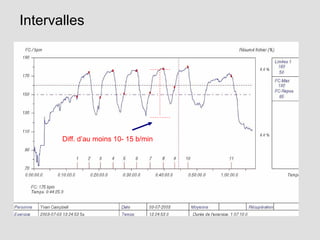 Intervalles
Diff. d’au moins 10- 15 b/min
 