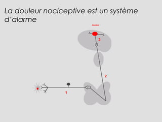 1
2
3
douleur
La douleur nociceptive est un système
d’alarme
 