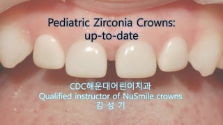 Pediatric Zirconia Crowns:
up-to-date
CDC해운대어린이치과
Qualified instructor of NuSmile crowns
김 성 기
 