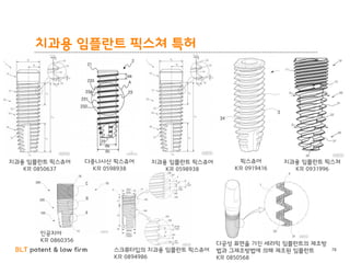 BLT patent & law firm
치과용 임플란트 픽스쳐 특허
78
치과용 임플란트 픽스츄어
KR 0850637
다중나사산 픽스츄어
KR 0598938
다공성 표면을 가진 세라믹 임플란트의 제조방
법과 그제조방법에 의해 제조된 임플란트
KR 0850568
치과용 임플란트 픽스츄어
KR 0598938
인공치아
KR 0860356
스크류타입의 치과용 임플란트 픽스츄어
KR 0894986
픽스츄어
KR 0919416
치과용 임플란트 픽스쳐
KR 0931996
 