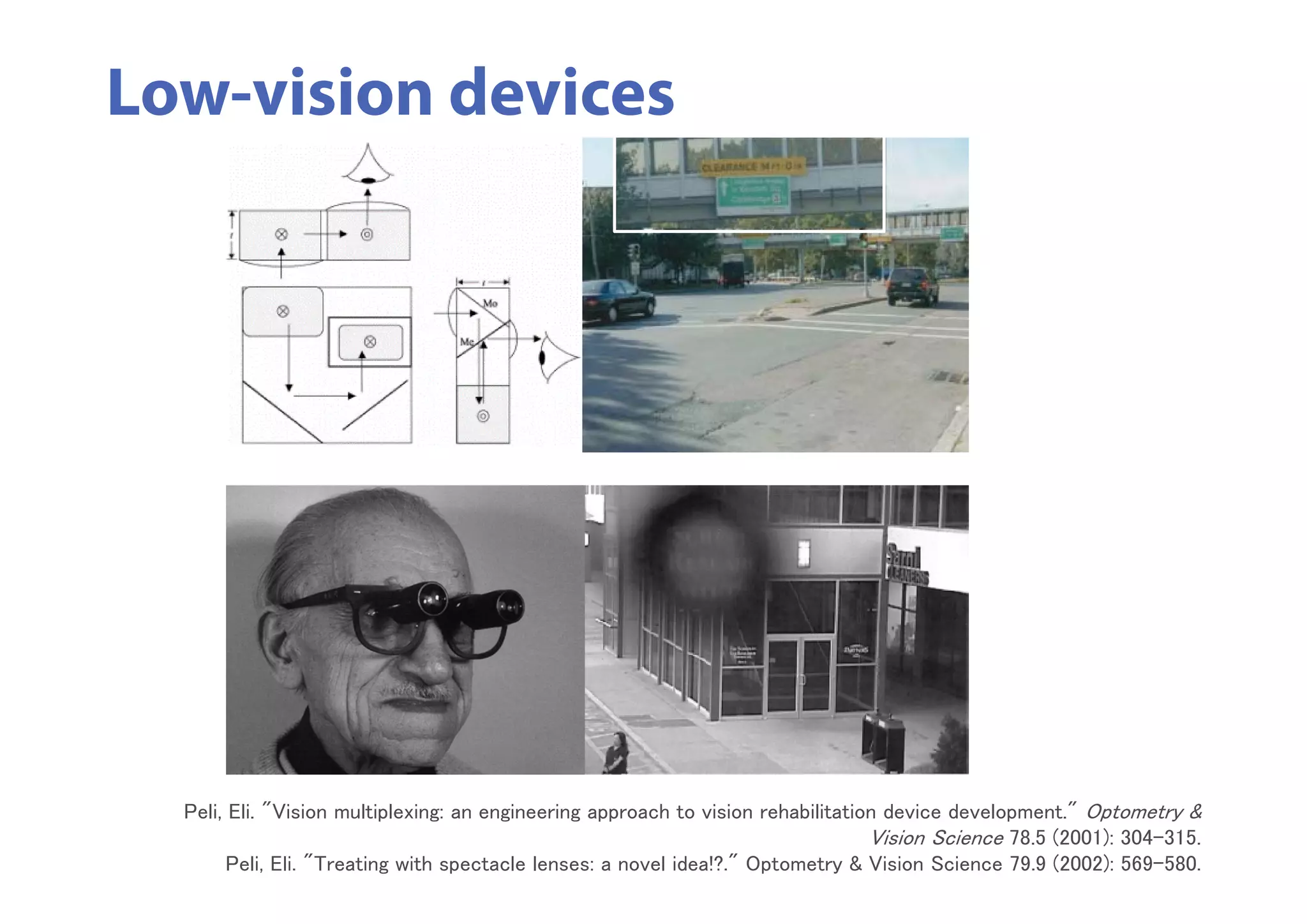 Low-vision devices
Peli, Eli. "Vision multiplexing: an engineering approach to vision rehabilitation device development." Optometry &
Vision Science 78.5 (2001): 304-315.
Peli, Eli. "Treating with spectacle lenses: a novel idea!?." Optometry & Vision Science 79.9 (2002): 569-580.
 