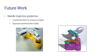 Future Work
• Needle trajectory prediction
• 3 potentiometers to measure angles
• Separate potentiometer holder
 