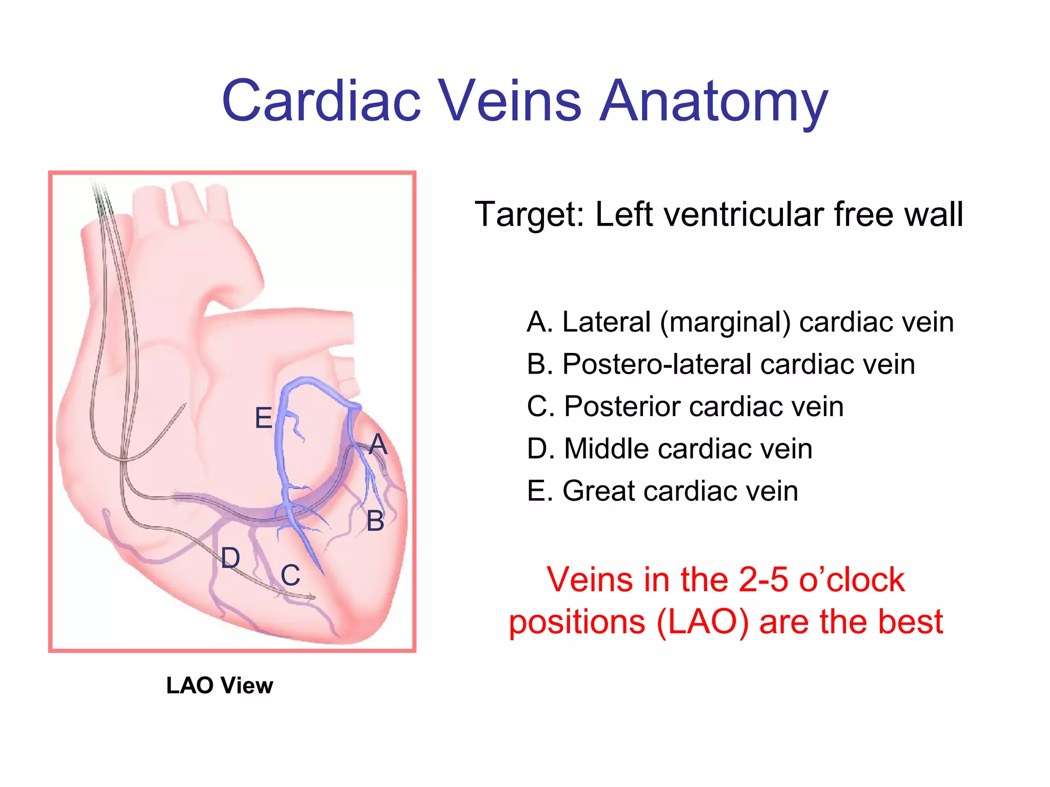 Lv Lead Pacemaker LV Lead Implantation Tools: Choices of LV Leads | PPT