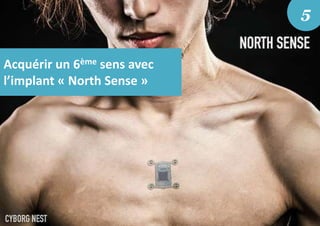 Acquérir un 6ème sens avec
l’implant « North Sense »
5
 