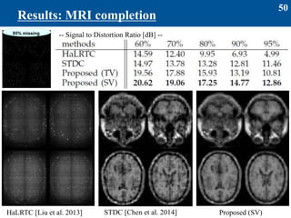50
Results: MRI completion
HaLRTC [Liu et al. 2013] STDC [Chen et al. 2014] Proposed (SV)
95% missing
-- Signal to Distortion Ratio [dB] --
 