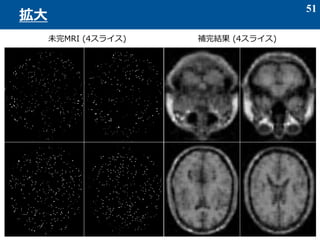 51
拡大
未完MRI (4スライス) 補完結果 (4スライス)
 