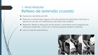 1. Nível Medular
Reflexo de extensão cruzada
 Examinar o lactente em DD.
 Estímulo: o examinador segura uma das pernas em extensão e fricciona a
planta do seu pé, em direção do calcanhar aos artelhos
 Resposta: flexão e abdução do MI oposto, movimento que é seguido por
adução e extensão, como se a criança quisesse afastar o estímulo.
 Leva a marcha automática.
 