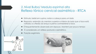 2. Nível Bulbo/ Medula espinhal alta
Reflexo tônico cervical assimétrico - RTCA
 Estímulo: bebê em supino; rodar a cabeça para um lado
 Resposta: extensão do membro superior e inferior do lado que a face está
voltada; e a flexão do braço e perna contralateral a face.
 É frequentemente observado em repouso. Mantem por pouco tempo
 É considerado um reflexo postural e assimétrico.
 Posição esgrimista
 