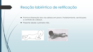 Reação labiríntica de retificação
 Promove liberação das vias aéreas em prono. Posteriormente, servirá para
o controle de cabeça.
 Presente desde o primeiro mês.
 