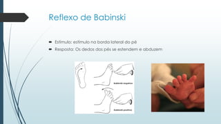 Reflexo de Babinski
 Estímulo: estímulo na borda lateral do pé
 Resposta: Os dedos dos pés se estendem e abduzem
 