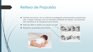 Reflexo de Propulsão
 Testado em prono. Ao se colocar os polegares pressionando a planta dos
pés, o bebê, estando com os membros inferiores em flexão, faz extensão
dos membros e se impulsiona para frente.
 Estímulo: fletir os MMII com apoio nos pés
 Resposta: propulsão para frente.
 