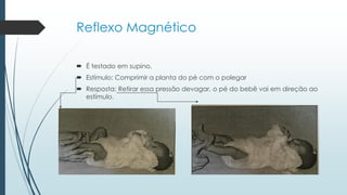 Reflexo Magnético
 É testado em supino.
 Estímulo: Comprimir a planta do pé com o polegar
 Resposta: Retirar essa pressão devagar, o pé do bebê vai em direção ao
estímulo.
 