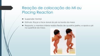 Reação de colocação do MI ou
Placing Reaction
 Suspensão Ventral
 Estímulo: Roçar a face dorsal do pé na borda da mesa
 Resposta: o membro inferior realiza flexão de quadril e joelho, e apoia o pé
na superfície da mesa.
 