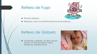Reflexo de Fuga
 Estímulo doloroso
 Resposta: choro ou tentativa de livrar-se do estímulo.
Reflexo de Glabela
 Comprime a glabela, os olhos devem
fechar. Se não fecharem, indica
paresia ou paralisia facial.
 