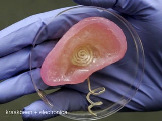 kraakbeen + electronica
 