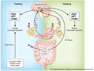 2012 Nature Medicine Shedding pounds after going under the knife
↑Agrp
↑NPY
↓POMC
↓Agrp
↓NPY
↑POMC
 