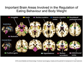 Important Brain Areas Involved in the Regulation of
Eating Behaviour and Body Weight
44
2016 Lancet Diabetes and Endocrinology. Functional neuroimaging in obesity and the potential for development of novel treatments
 