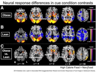 Neural response differences in cue condition contrasts
2014 Diabetes Care. Leptin Is Associated With Exaggerated Brain Reward and Emotion Responses to Food Images in Adolescent Obesity
High Calorie Food > Non-Food46
 