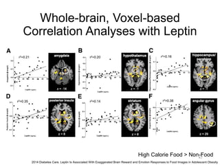Whole-brain, Voxel-based
Correlation Analyses with Leptin
2014 Diabetes Care. Leptin Is Associated With Exaggerated Brain Reward and Emotion Responses to Food Images in Adolescent Obesity
High Calorie Food > Non-Food47
 