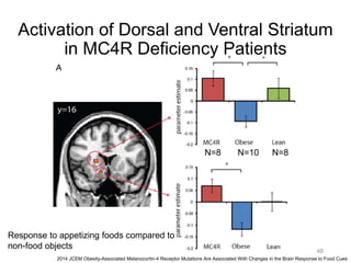 48
2014 JCEM Obesity-Associated Melanocortin-4 Receptor Mutations Are Associated With Changes in the Brain Response to Food Cues
Activation of Dorsal and Ventral Striatum
in MC4R Deficiency Patients
Response to appetizing foods compared to
non-food objects
N=8 N=10 N=8
 
